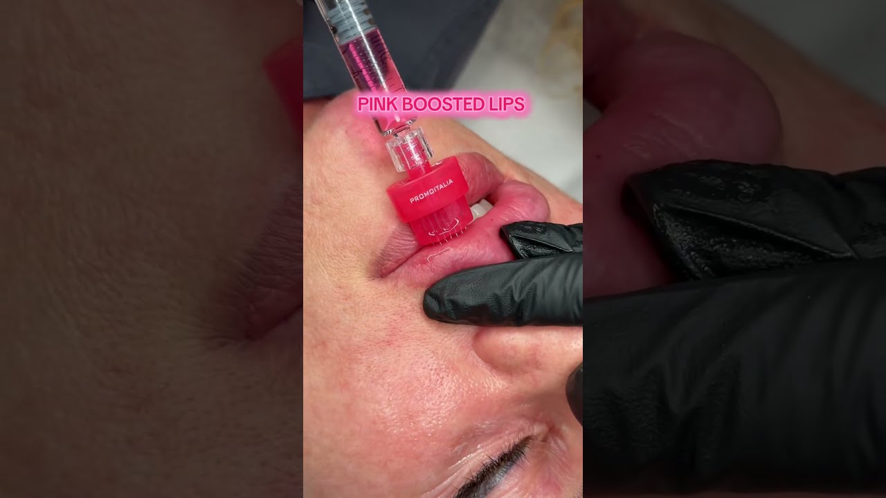 Pink Booster Treatment Explained 7 Amazing Benefits Cost Real Results