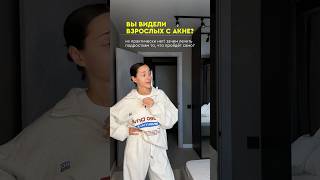 А вам тоже в детстве говорили: «мой лицо мылом, и всё пройдет»?👇🏻