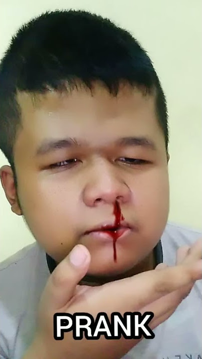 PRANK HIDUNG BERDARAH