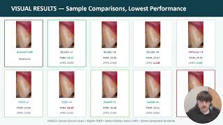 AI-based Super-Resolution of Single Tooth RGB Images