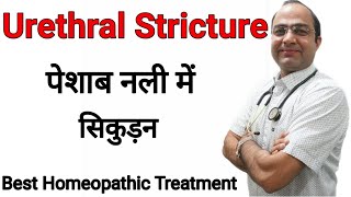 Urethral stricture | पेशाब नली सिकुड़ना ।मूत्र मार्ग में माँस