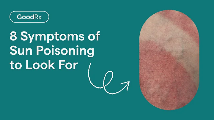 8 Common Symptoms of Sun Poisoning | GoodRx