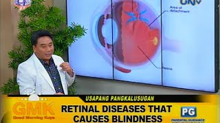 Retinal Disease that causes blindness