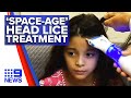 New 'space-age' head lice treatment