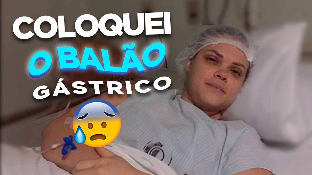 Balão Gástrico: O dia o procedimento - Demora colocar Balão Gástrico ...
