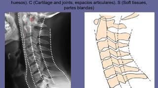 Anatomia radiologica de la columna vertebral
