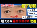 【眉下切開】三角目と目の下のたるみが悩みだった男性の手術!傷跡を目立たなくするための切開ラインを解説【メンズ整形】