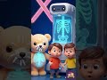 X for X-Ray ❌ | ABC Learning for Kids |  #kidslearning #kidscartoon #alphabetforkids