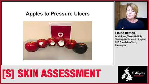 TVN2gether Virtual Stop the Pressure 2020 Episode 2