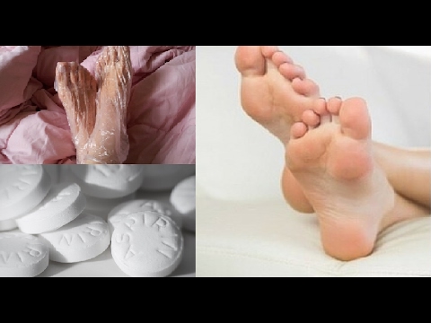 remover calos com aspirina remover calos com aspirina
