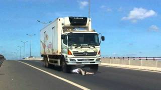 BI CAN QUA NGUOI TAI CAU CAN THO - BV MẮT-RHM CẦN THƠ 39. NGUYỄN TRÃI . WEB : NHANKHOACANTHO.COM
