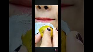 Chin blackhead & Whitehead removing at home remedy??Shorts Youtube