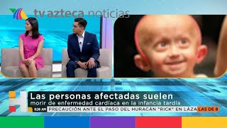 'El curioso caso de Benjamin Button' tiene explicación científica. ¿Qué es la progeria? 'El curioso caso de Benjamin Button' tiene explicación científica. ¿Qué es la progeria?