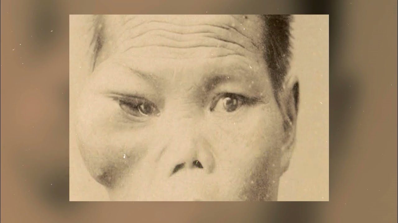 Fascinating Early Medical Oddities