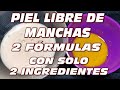 PIEL LIBRE DE MANCHAS, 2 FORMULAS CON SOLO 2 INGREDIENTES CASEROS, MUY EFICACES, PARA PIELES MADURAS