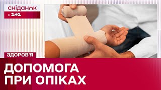 Опіки шкіри: правила першої допомоги та лікування!
