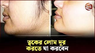 অবাঞ্ছিত লোম দূর করার সহজ উপায় | Channel 24 | Unwanted Hair