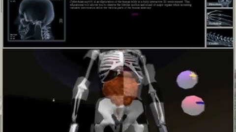 Silicon Graphics. General Demo: CyberAnatomy101