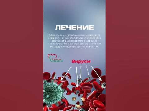 Лечение хиджамой www.centr-Avicenna.ru - YouTube