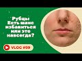 РУБЦЫ/ Есть шанс избавиться или это навсегда