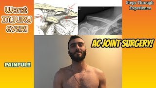 AC Joint (Shoulder) Separation Reconstruction Surgery Experience | DAYS 1-2