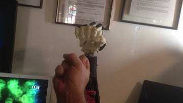 Open Source Prosthetic Arm