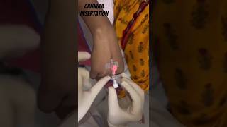 IV Cannulation? cannula doctor medico medical viral newstatus shorts intramuscular_injection