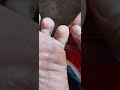 Foot peel satisfying