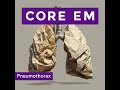 Episode 213: Pneumothorax