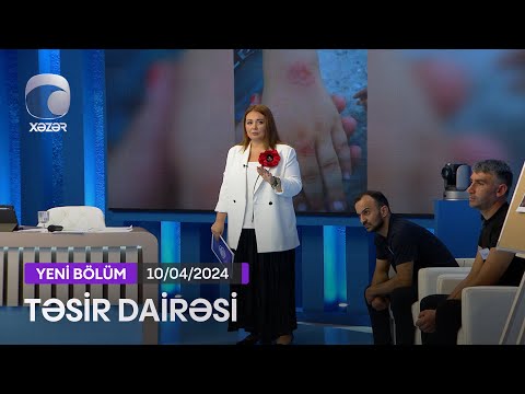 Təsir Dairəsi - 10.04.2024