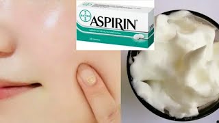 ASPIRINDAN YUZNI CHUQUR TOZALOVCHI NIQOB #aspirin#va#asaldan#ajoyib#niqob