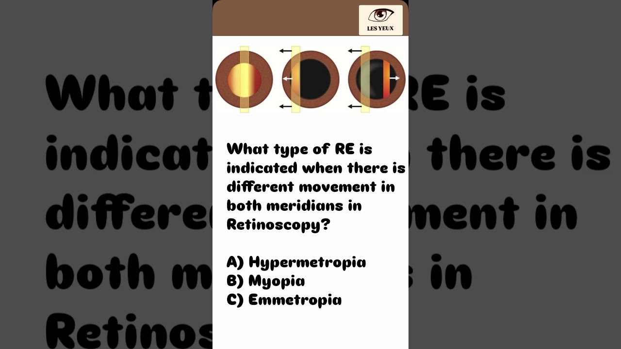 MCQ&rsquo;S FOR OPTOMETRIST EXAMS DHA|HAAD|MOH #optometrists #optometryacademy #optometry #optometrylife