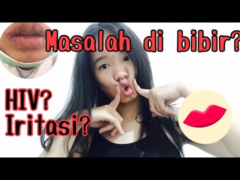 pengalaman-masalah-di-bibir?-hiv?iritasi?--cara-pertama-yang-harus-dilakuin...-#expol1