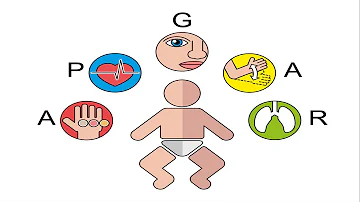 Qual a classificação da prematuridade?