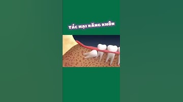 [3D] TÁC HẠI RĂNG KHÔN | Nha Khoa Quốc Tế Athena