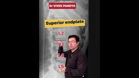 The lumbar spine lateral view  #xray #spine