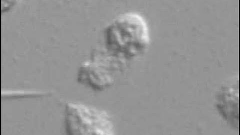 Neutrophil Chemotaxis