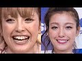 【比較画像】芸能人の悪い歯並びのビフォーアフター画像集