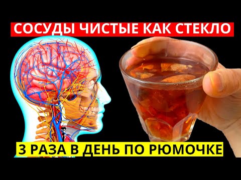 Чистка сосудов от холестерина и от тромбов в домашних условиях народными средствами без лекарств