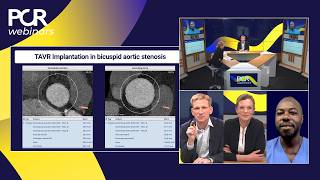 Information TAVI in bicuspid aortic stenosis: lessons learned and remaining unknowns - Webinar Guide
