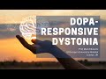 Dopa-responsive Dystonia | DYSTONIA FACTS | Prof Mark Edwards