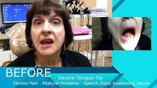 Trouble Speaking, Swallowing and Standing Straight - Part 1