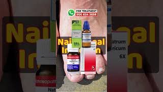 Homeopathic Medicine for Nail Fungus Infection