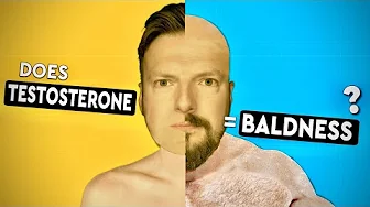 Does Testosterone Make You Go Bald? DEBUNKED