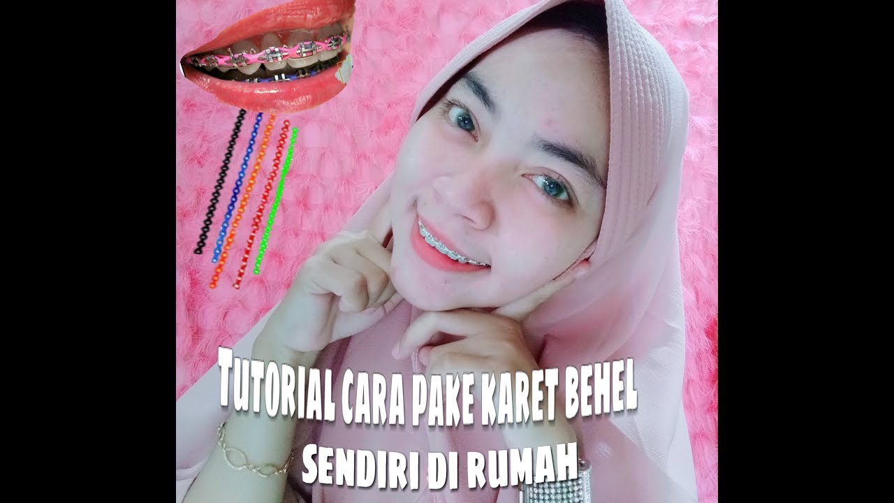 Tutorial cara pasang karet behel secara praktis di rumah 