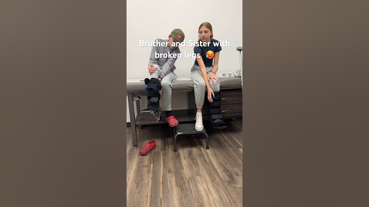 Two broken legs #sibblings