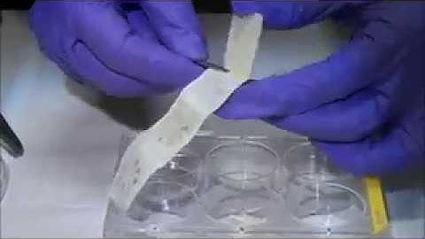 Usage of microfluidic cloth-based analytical device (uCAD) for multiple assays