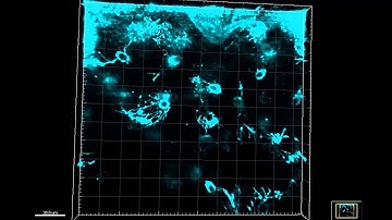 Long-term two-photon neuroimaging with a photostable AIE luminogen