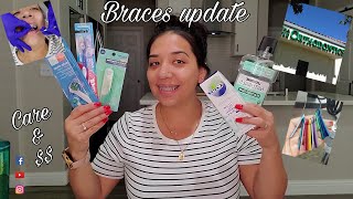 Adult Braces | Are you thinking about getting them? I say DO IT!! #BRACESOVER30 #BRACES #ADULTBRACES