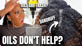 Oils DON'T Help Dry Scalp & Dandruff? | Black Hair